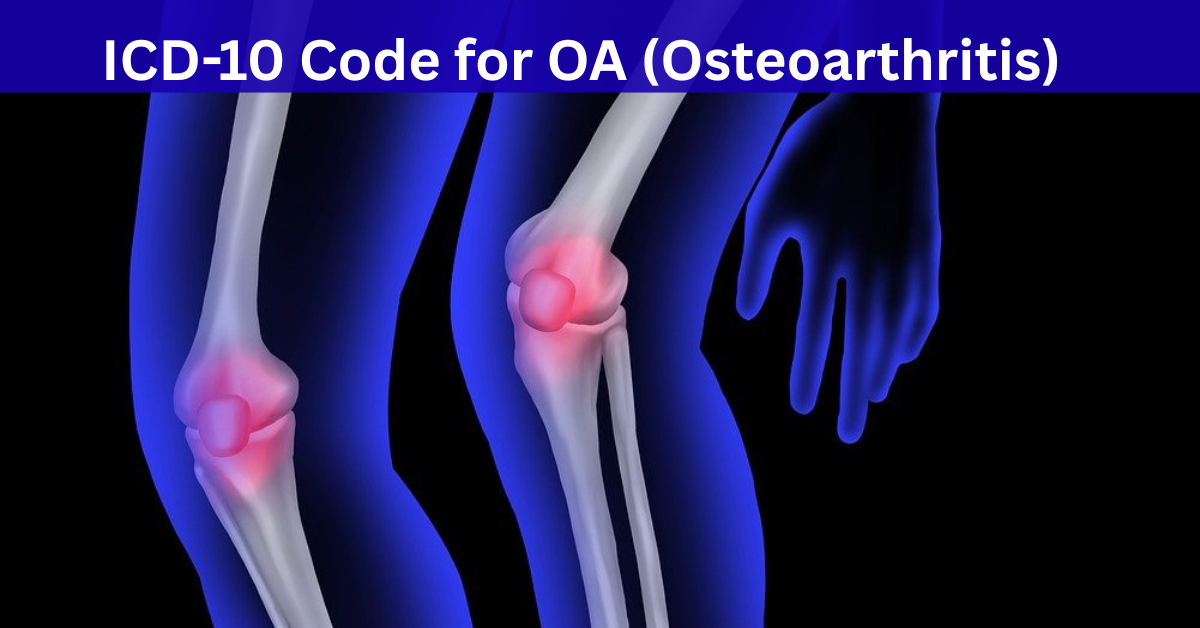skeleton of both knees, ICD-10 Code for OA