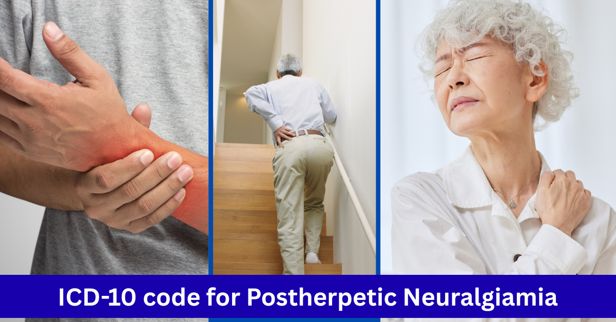 ICD-10 Code for Postherpetic Neuralgia (phn)