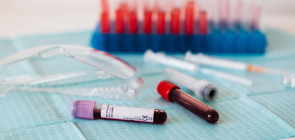 ICD-10 Code for High Alkaline Phosphatase