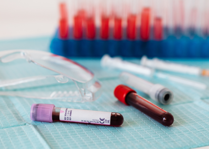 ICD-10 Code for High Alkaline Phosphatase