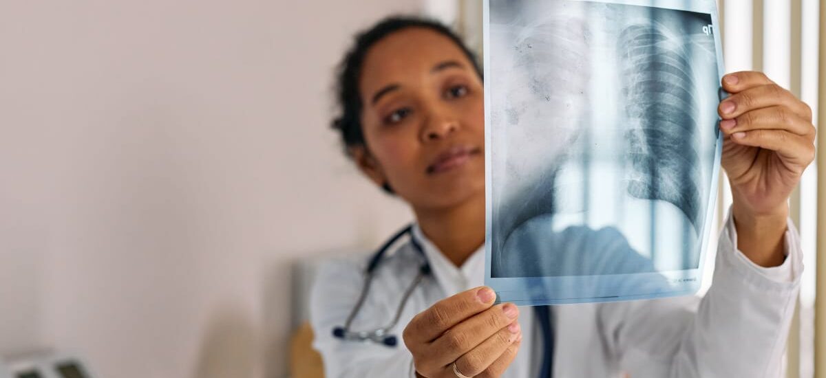 Acute Hypoxic Respiratory Failure