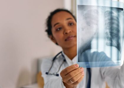 Acute Hypoxic Respiratory Failure