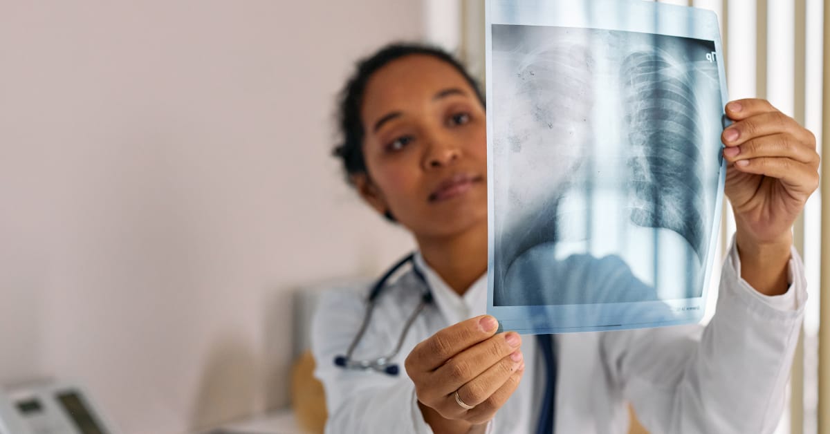 Guide to the ICD-10 Code for Acute Hypoxic Respiratory Failure